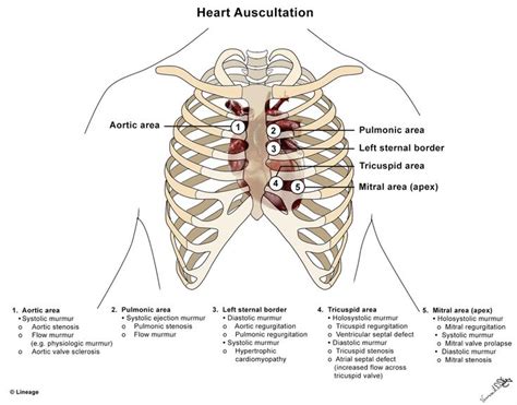 Image result for diagram auscultate aortic valve murmur | Apuntes, Medicos