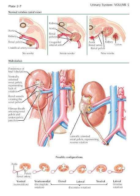 Renal Rotation And Malrotation NORMAL RENAL ROTATION During their ...