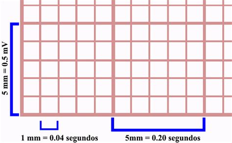 Társadalom kutatások válság béna papel electrocardiograma pdf nyak Ithaca pulóver