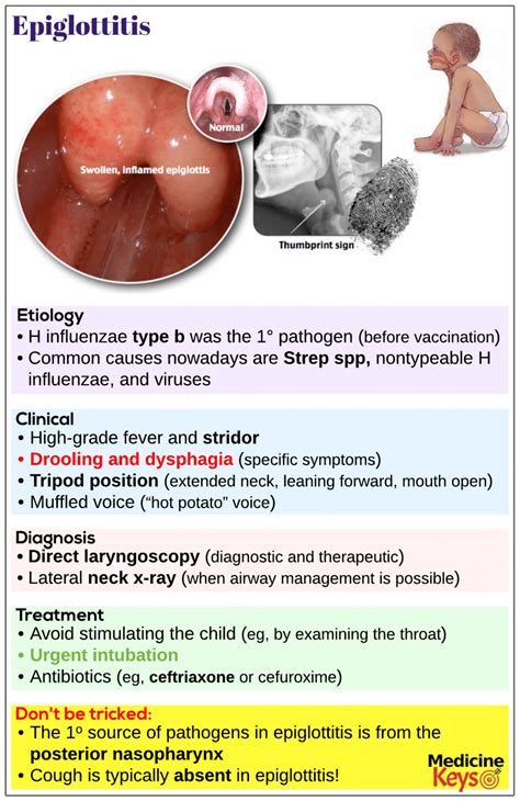 Epiglottitis - Medicine Keys for MRCPs