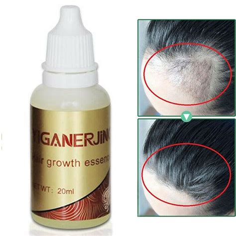 20ml 100% Natural Ginger Hair Growth Essential Oil. Liquid Hair Loss . products leave-in Hair ...