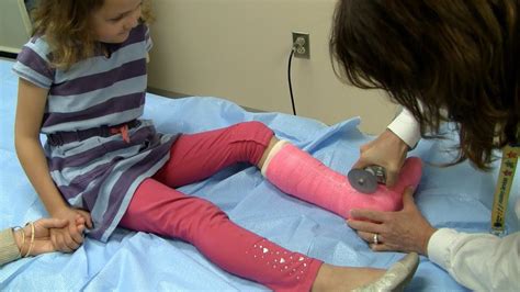 Watch a cast being removed from a child - YouTube