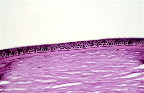 HLS [ Eye, eye, corneal epithelium] HIGH MAG