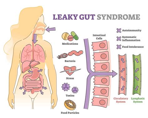 The Conundrum of a Leaky Gut — FAIM