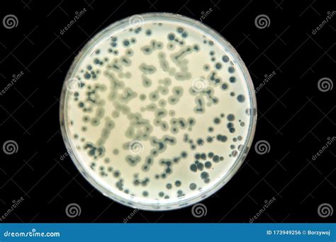 Plaque Formation Bacteriophage at Anthony Molinaro blog