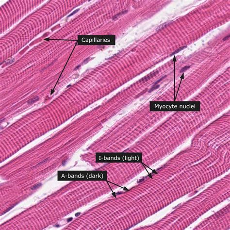 Dictionary - Normal: Skeletal muscle | Tissue biology, Human anatomy ...