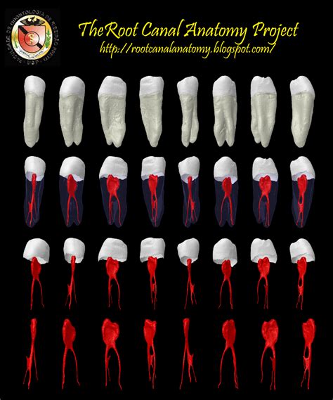 The Root Canal Anatomy Project: Mandibular First Premolar