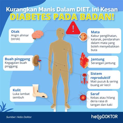 Mengenal Diabetic Retinopathy Komplikasi Diabetes Yan - vrogue.co