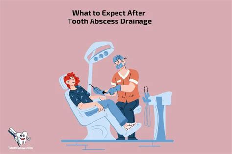 What To Expect After Tooth Abscess Drainage? Reduced Pain!