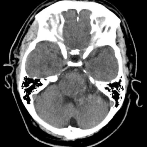 MRA head with contrast, sagittal section | Download Scientific Diagram