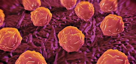 Primary Myelofibrosis - Cancer Health