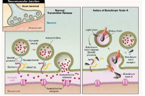 Botulinum Toxin: Mechanism Of Action And Clinical Use, 51% OFF