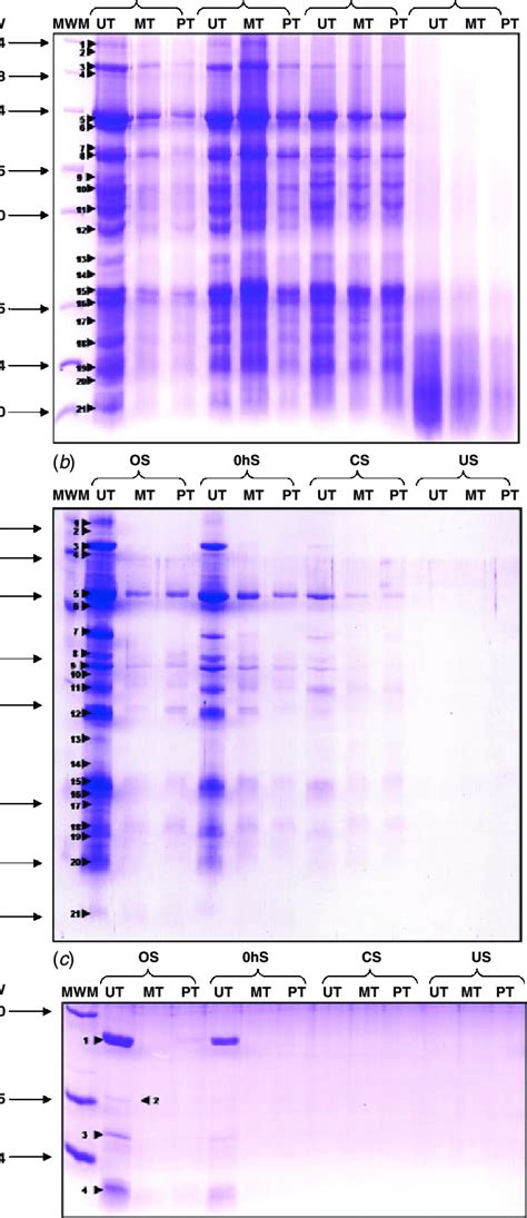 SDS-gel electrophoresis of (a) total proteins, (b) globulins and (c ...