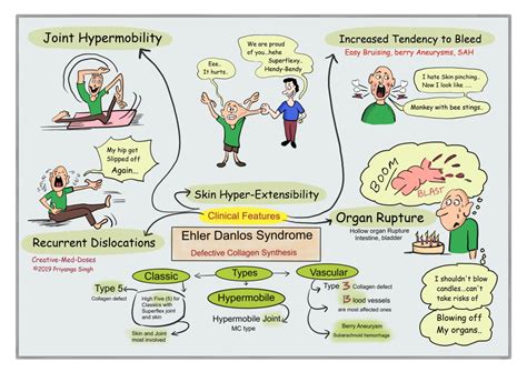 Ehlers-Danlos Syndrome (EDS) - Creative Med Doses