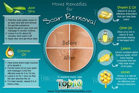 Home Remedies for Scar Removal | Top 10 Home Remedies