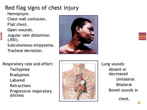 Chest trauma