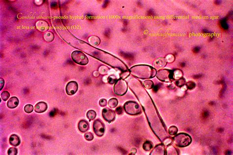 Candida albicans (1000X magnification) | Classified as Yeast… | Flickr