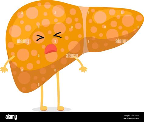 Hepatitis acute and chronic Stock Vector Images - Alamy