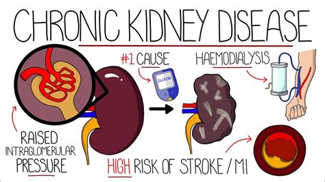 Chronic Kidney Disease Symptoms, Stages, Causes, Risk, 49% OFF