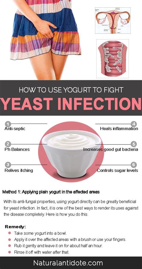 Pin by Sarah Shand on Health Care Tips | Treat yeast infection, Yeast infection treatment, Yeast ...