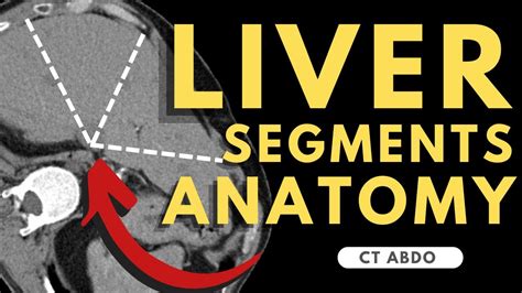 Liver Segmental Anatomy Ct Scan