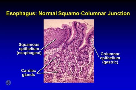 Gastroesophageal Junction Histology Labeled