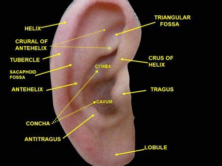 Auricular perichondritis - WikEM