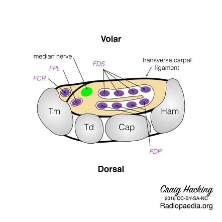 Carpal tunnel | Radiology Reference Article | Radiopaedia.org