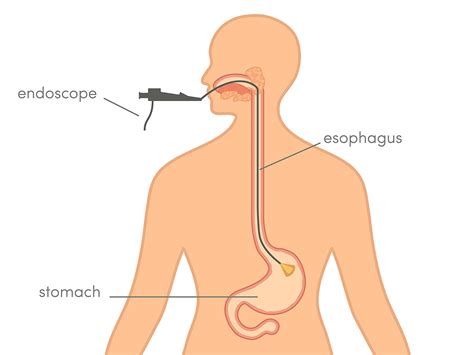 A/Prof Jaber | Gastroscopy and Colonoscopy