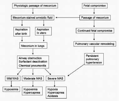 MECONIUM ASPIRATION SYNDROME : Causes, Diagnosis - Vaidyaनमः