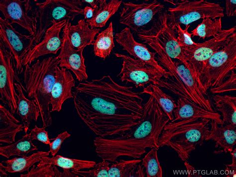 CREST antibody (CL488-12439) | Proteintech