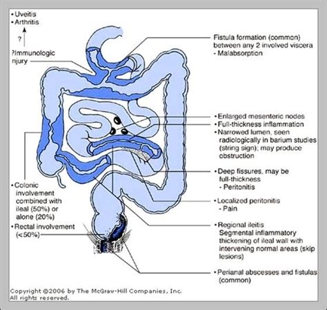 terminal ileum anatomy | Anatomy System - Human Body Anatomy diagram and chart images