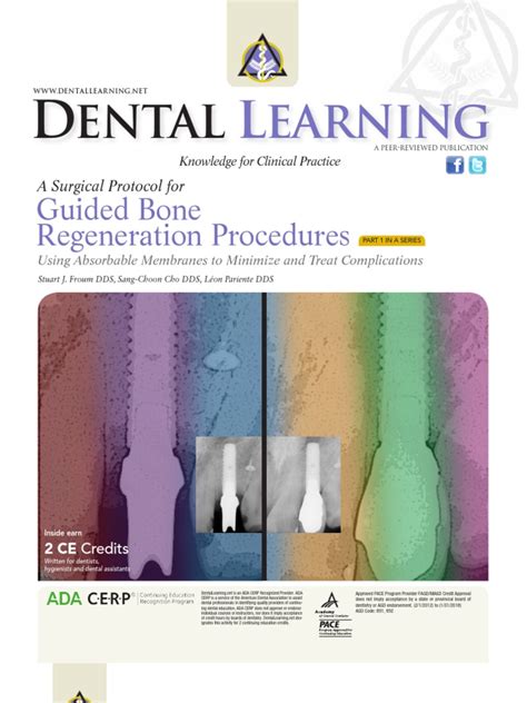 Guided Bone Regeneration Procedure | Dental Implant | Surgical Suture