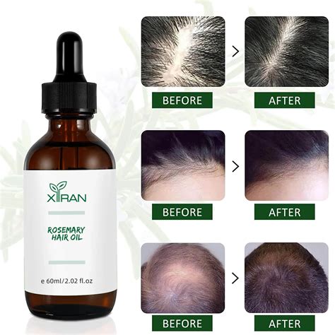 Customized Organic Pure Rosemary Oil For Men Women Anti Hair Loss Biotin Hair Growth Oil