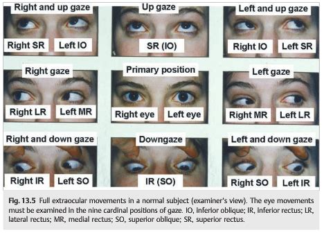 Inferior Oblique Eye Movement