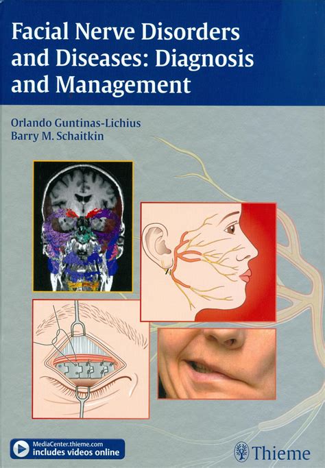 Facial Nerve Disorders and Diseases: Diagnosis and Management