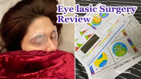 Eye Lasik surgery- Honest Review and my Experience!!! - YouTube