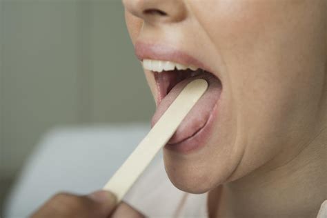 Is 'COVID tongue' the newest symptom? Here's why experts aren't convinced.