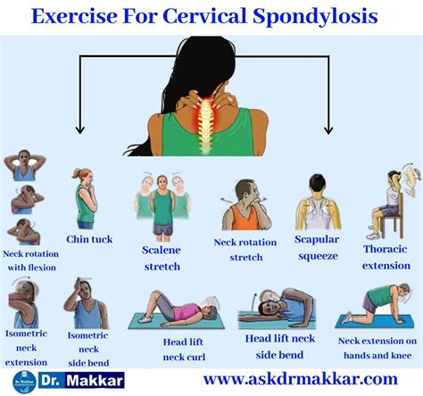 Cervical spondylosis || Neck Pain || Neck Pain leads to Giddiness ...