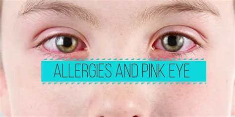 Pink eye symptoms: Discover how to recognize them properly and get ...