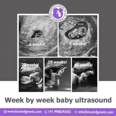 Week By Week Baby Ultrasound | Surrogacy india