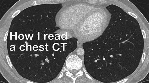 How I Read a Chest CT - YouTube