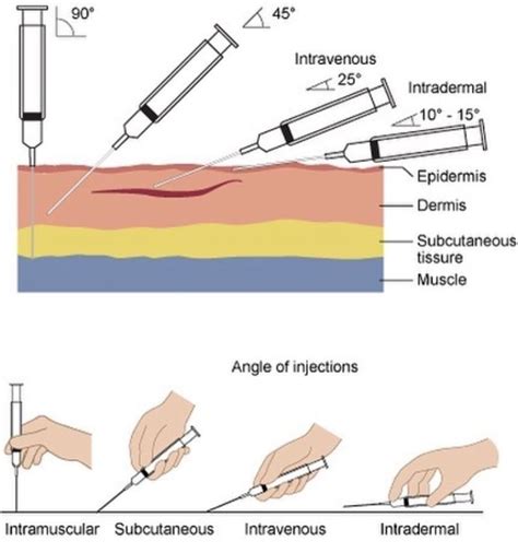 Iv Injection Sites Diagram Leg Iv Injection Sites Diagram Ar