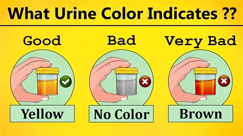What The Urine Color States About Your Health ? | Urine Infection, Urine Diseases, Urine Problem ...