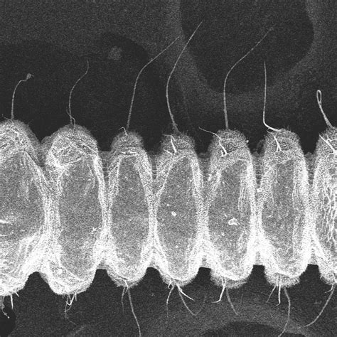 First larval stage (original) Fig. 2 Second larval stage (original) | Download Scientific Diagram