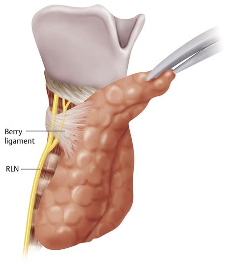 13 Conventional Thyroidectomy | Ento Key