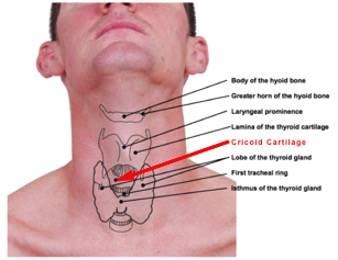 Cricopharyngeus Spasm and What to Do About It - Laryngopedia