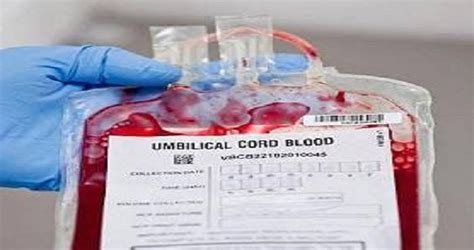 Human Umbilical Cord Blood for Progenitor Cell Transplant – Primary ...