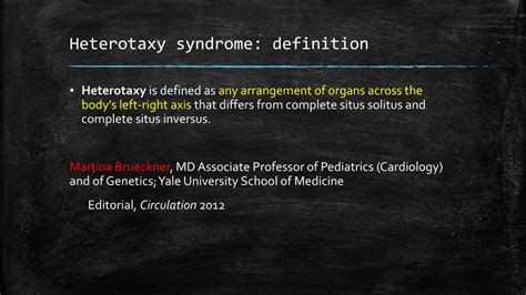 PPT - Congenital heart defects and heterotaxy syndrome PowerPoint Presentation - ID:2282637