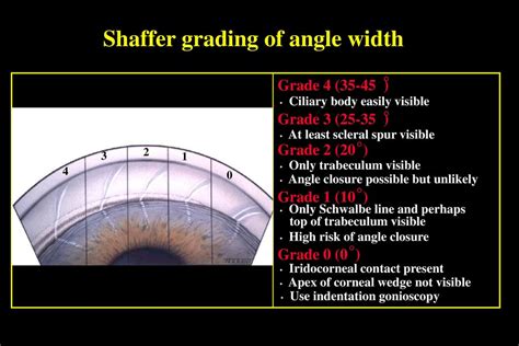 INTRODUCTION TO GLAUCOMA - ppt download